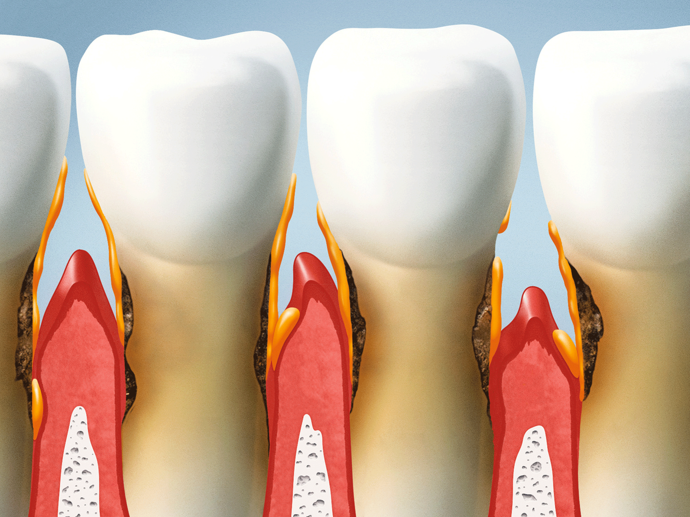 denti-gengive-osso-legamenti-parodonto-stefania-barbieri