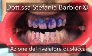 azione del rivelatore di placca stefania barbieri