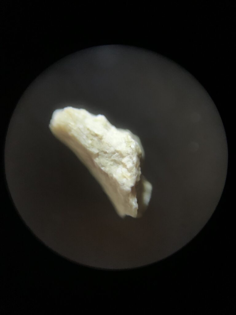 Frammento di tartaro (1,2 mm) visto al microscopio